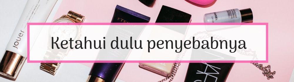 5 Solusi Untuk Kulit Kepala Yang Kering Dicoba Yuk