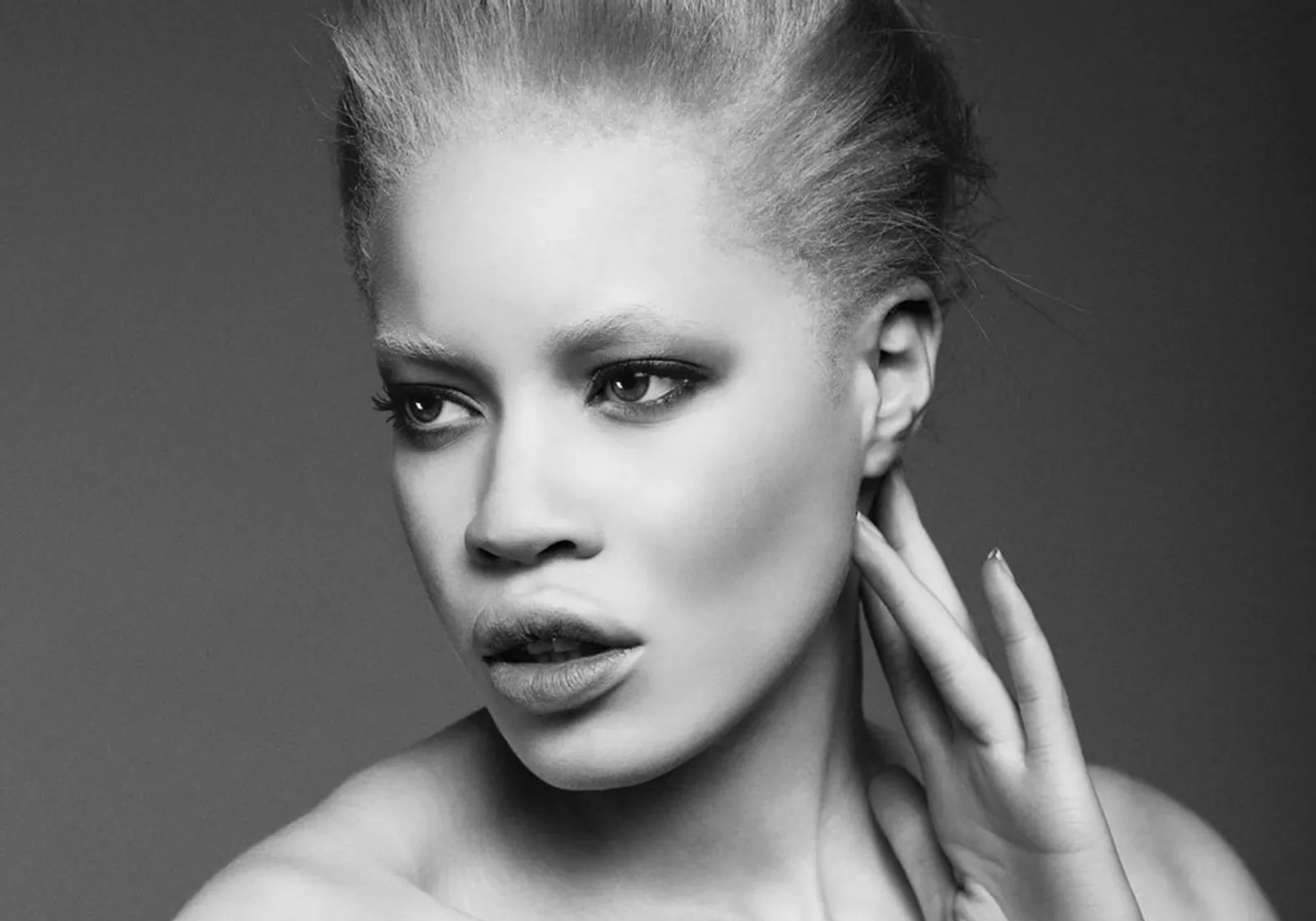 Brand Kosmetik Ini Gandeng Model Albino untuk Jadi Bintang Iklan