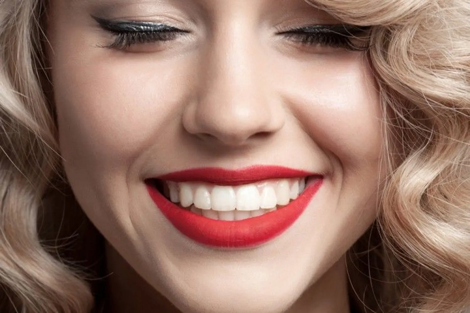 5 Hal Yang Harus Kamu Tahu Tentang Veneer Gigi