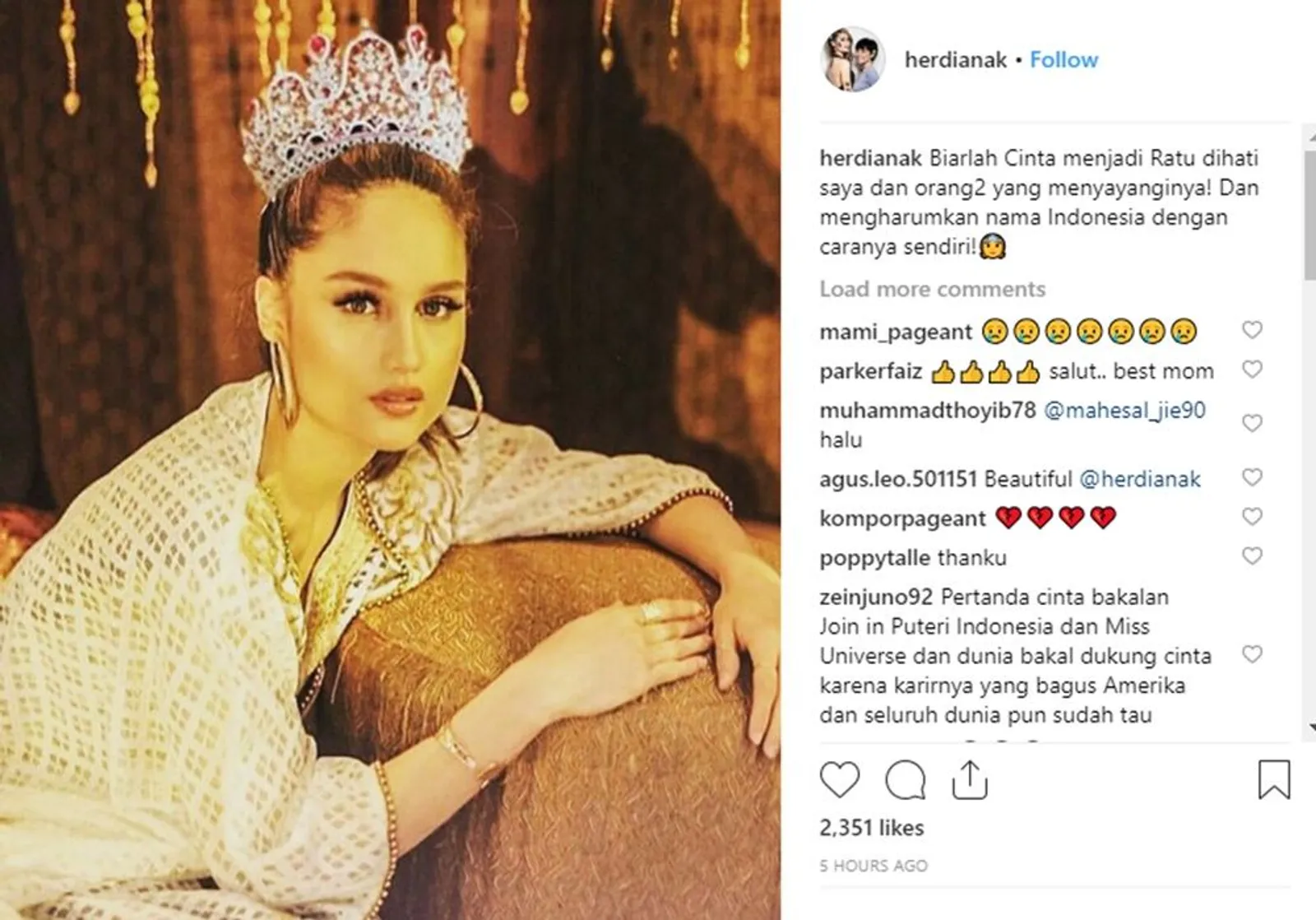 Sarat Prestasi, Cinta Laura Wakilkan Indonesia di Miss Universe 2019?