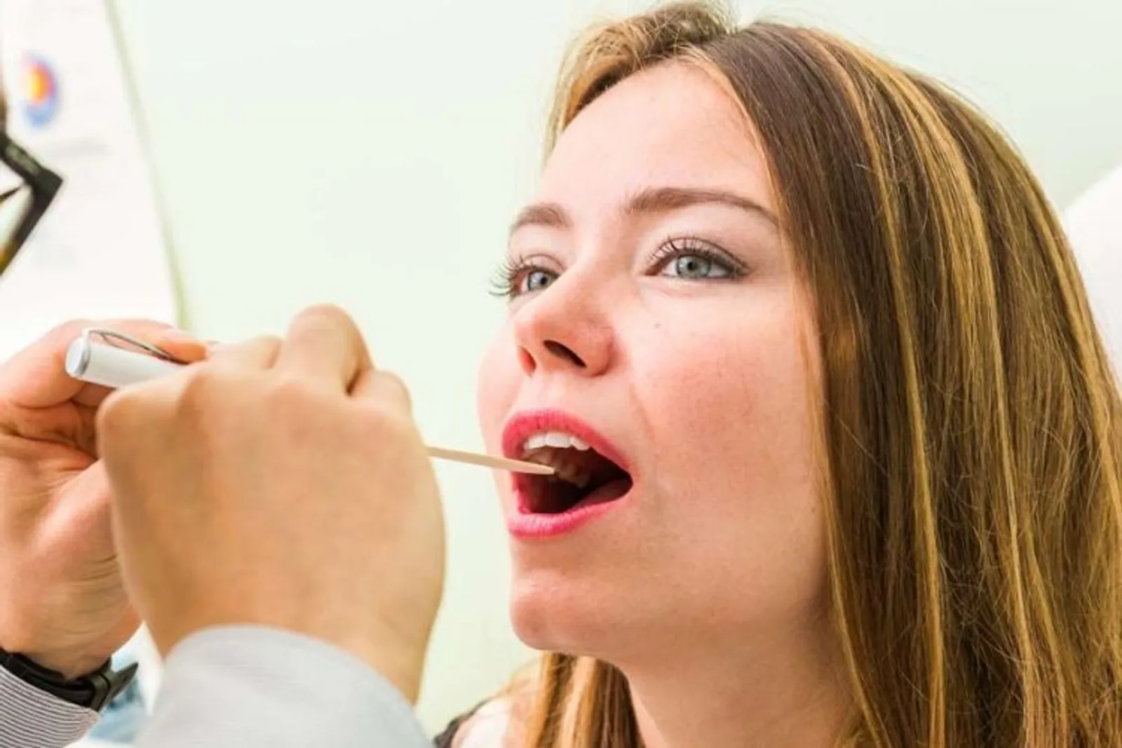 Inilah 7 Cara Mencegah Karang Gigi
