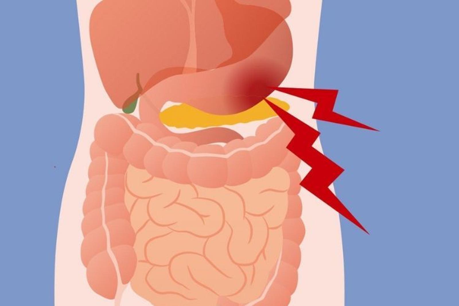 Tidak Boleh Sembarangan, Ini Bahaya Mengonsumsi Obat Pelangsing