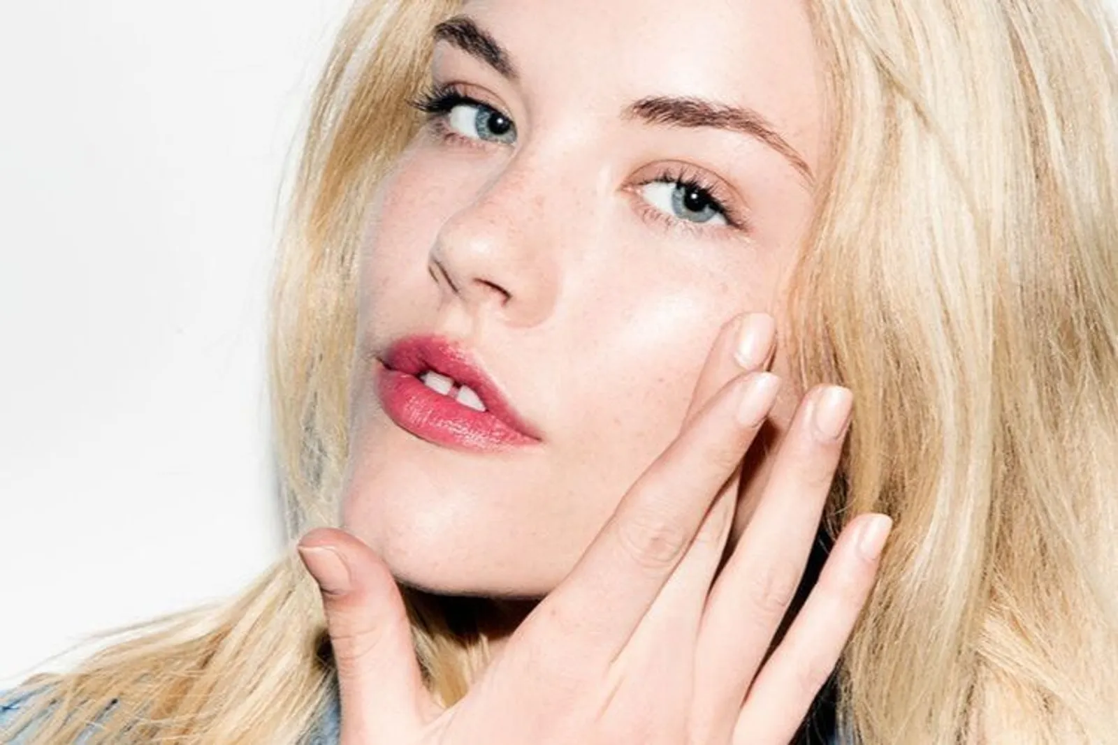Bisa Ganggu Makeup! 5 Fakta Soal Milia, Benjolan Kecil di Area Mata 