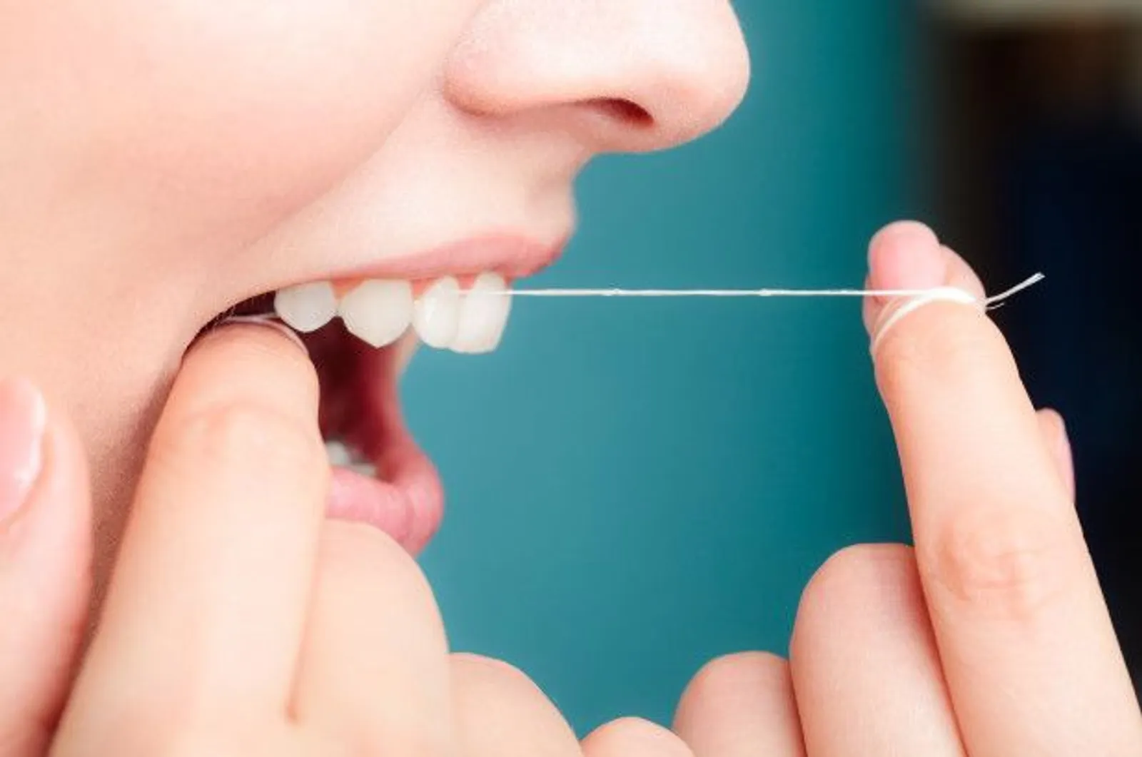 7 Penyebab Karang Gigi yang Tidak Boleh Disepelekan
