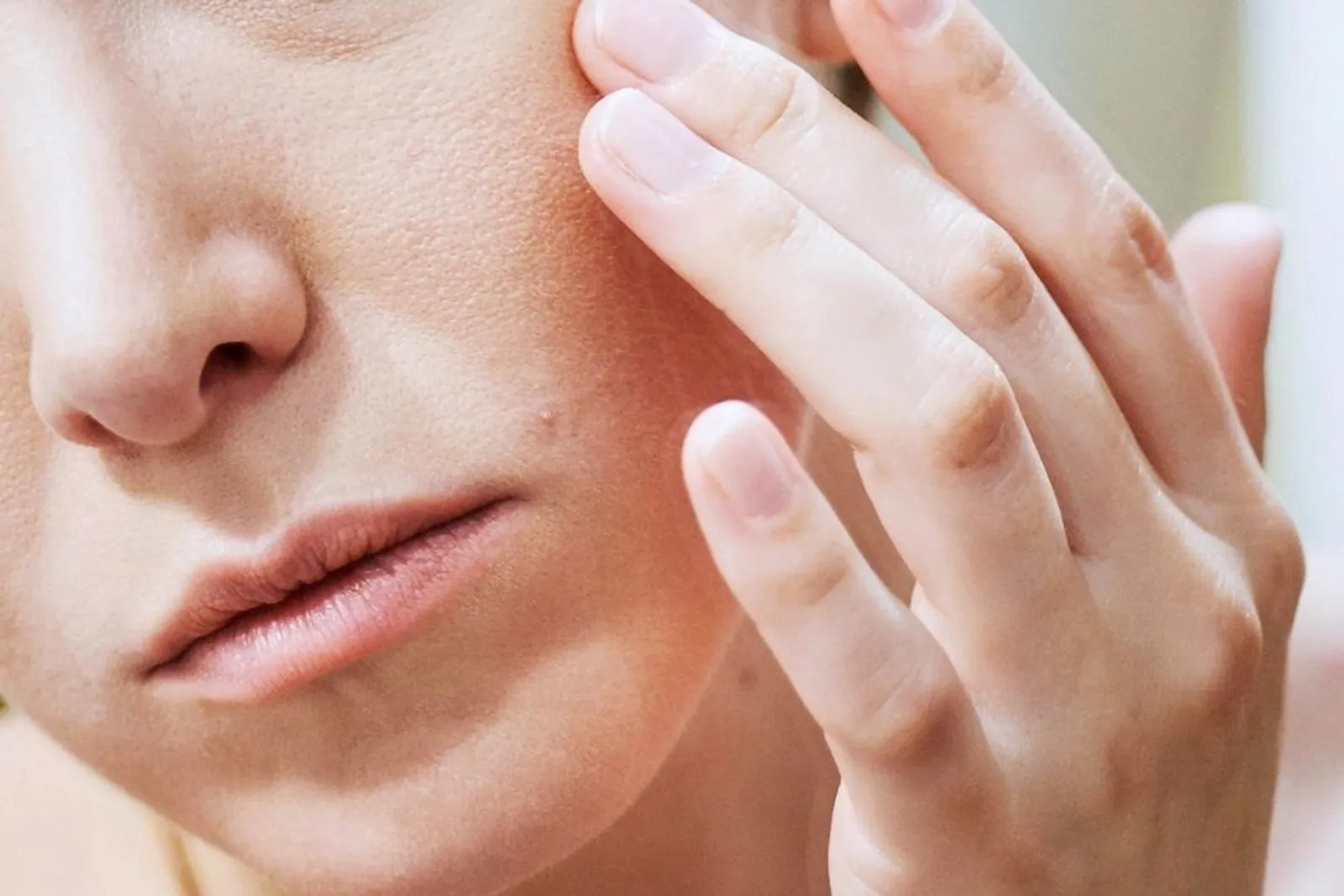 Mengenal Eczema, Penyakit Kulit yang Memicu Stres