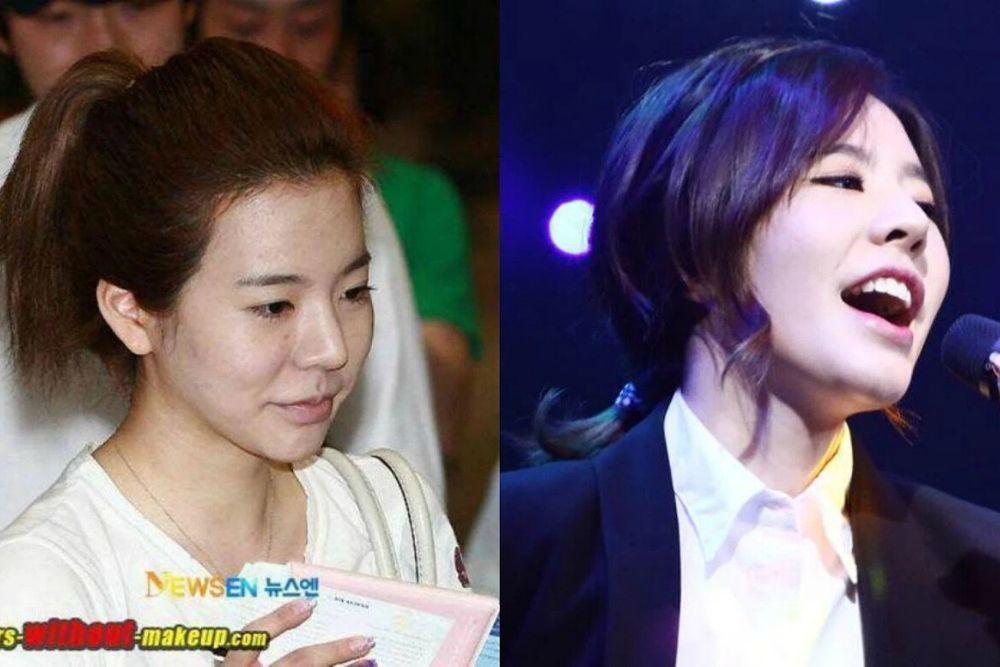 Punya Wajah Mulus, 9 Artis Korea Ini Pernah Berjuang Melawan Jerawat