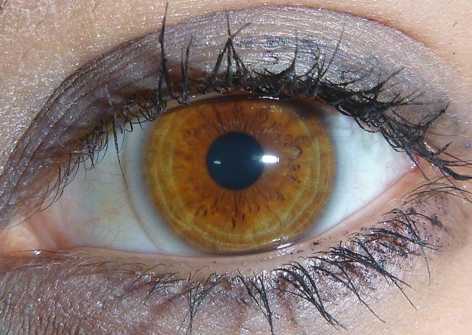 7 Kondisi Mata Ini Bisa Menjelaskan Bagaimana Kondisi Kesehatanmu