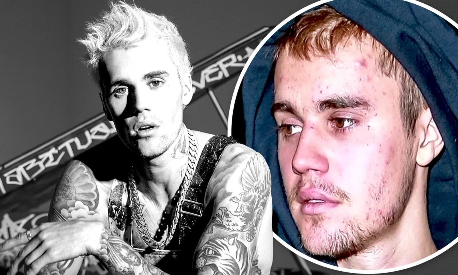 Sempat Depresi, Justin Bieber Akui Ketakutan Saat Garap Album Changes 