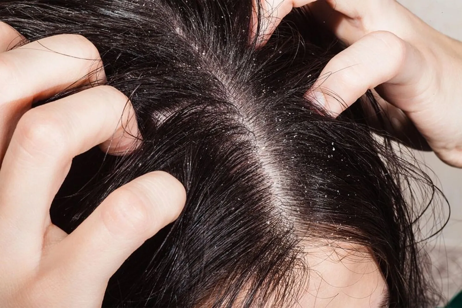 Jangan Angap Sepele, Ini 7 Dampak Tidur dalam Keadaan Rambut Basah