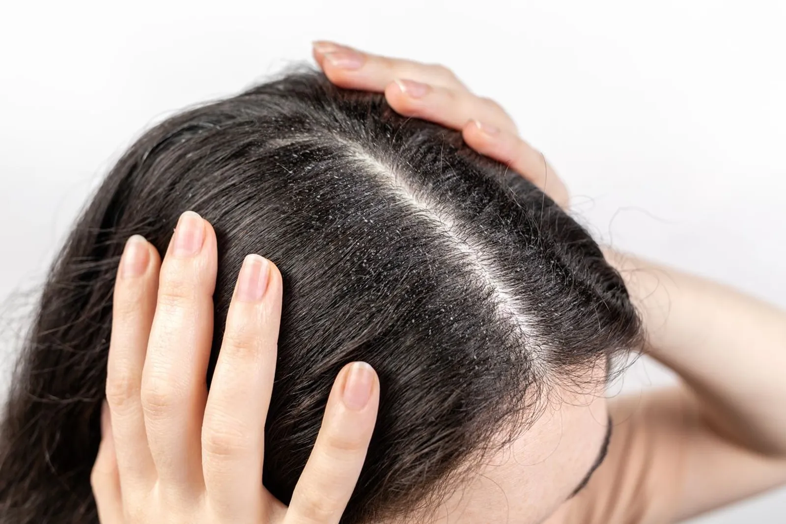 Tak Hanya untuk Kulit, Ini Manfaat Panthenol untuk Kesehatan Rambut
