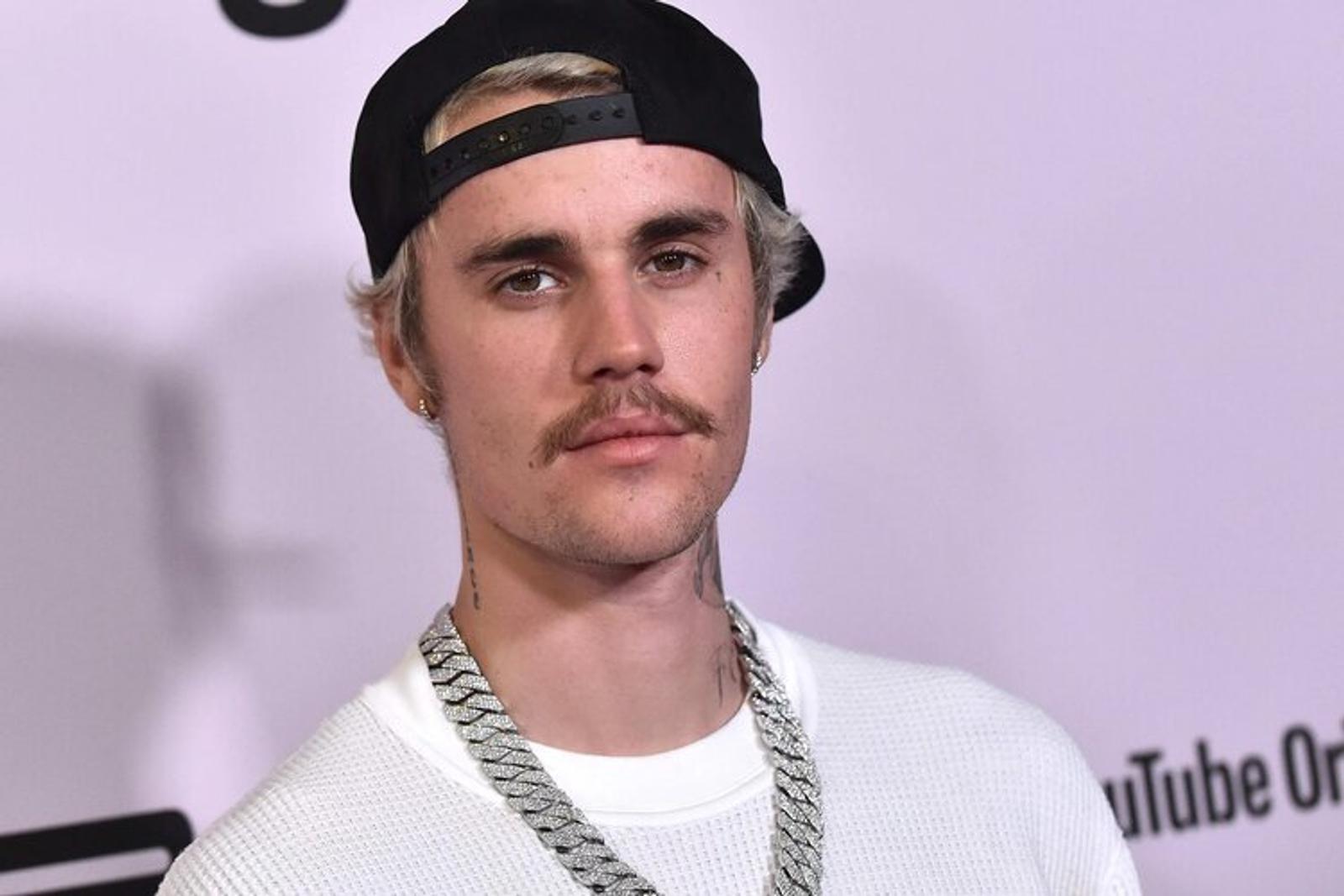 Wajah Justin Bieber Lumpuh, Ini Fakta Tentang Sindrom Ramsay Hunt