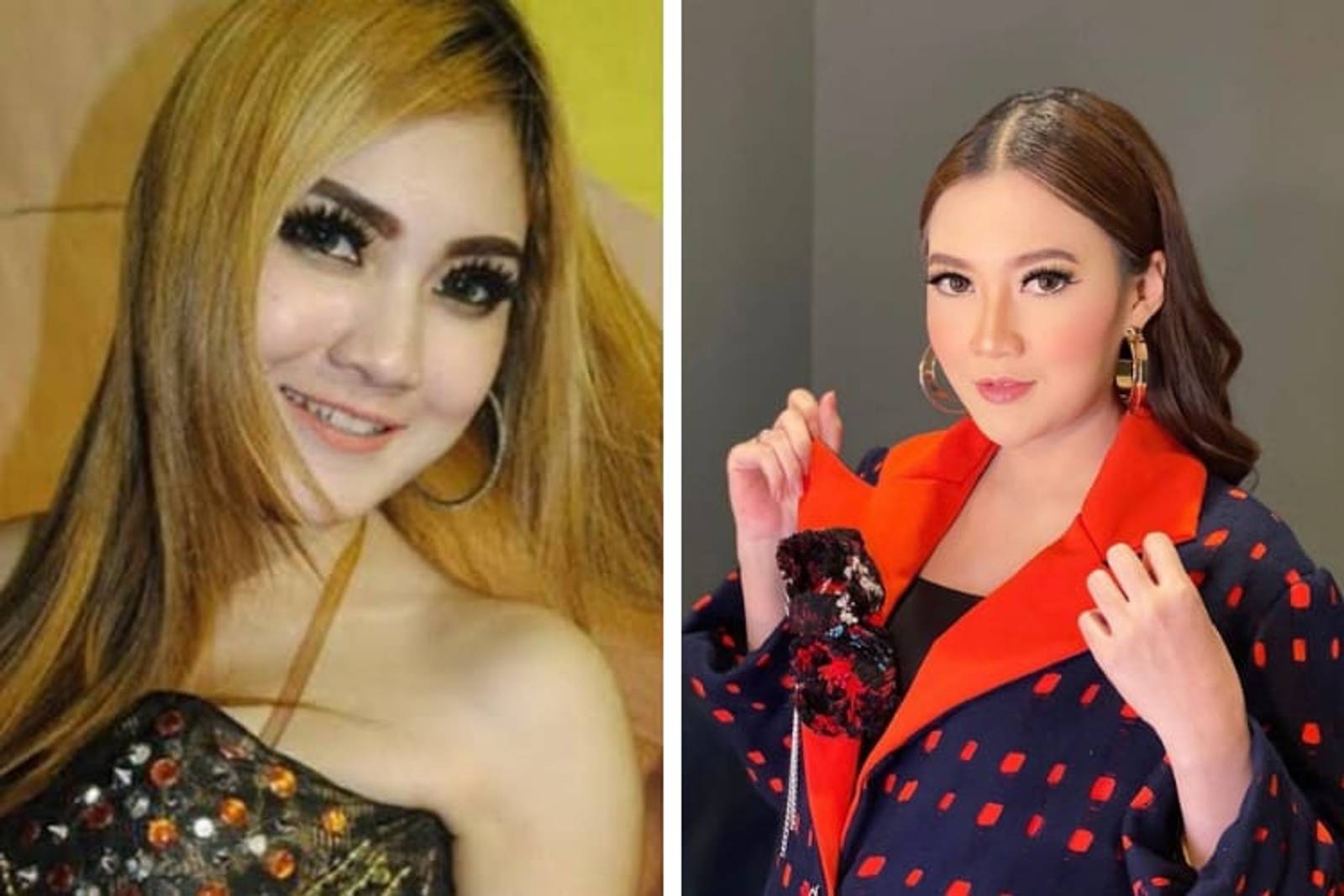 7 Potret Dulu dan Sekarang Artis Dangdut Tanah Air, Makin Glow Up!