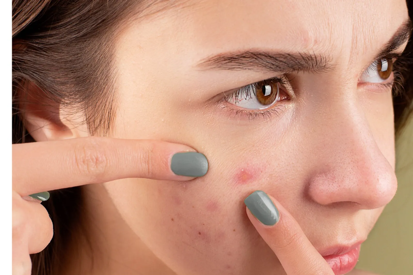 7 Ciri-Ciri Skincare Tidak Cocok pada Kulitmu, Perhatikan!