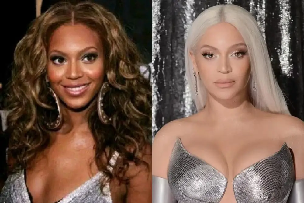 Beyonce & Deretan Artis Hollywood yang Dituding Mencerahkan Kulit