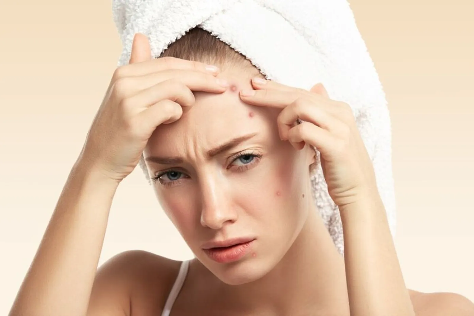 5 Perbedaan Fungal Acne dan Bruntusan yang Sering Disamakan
