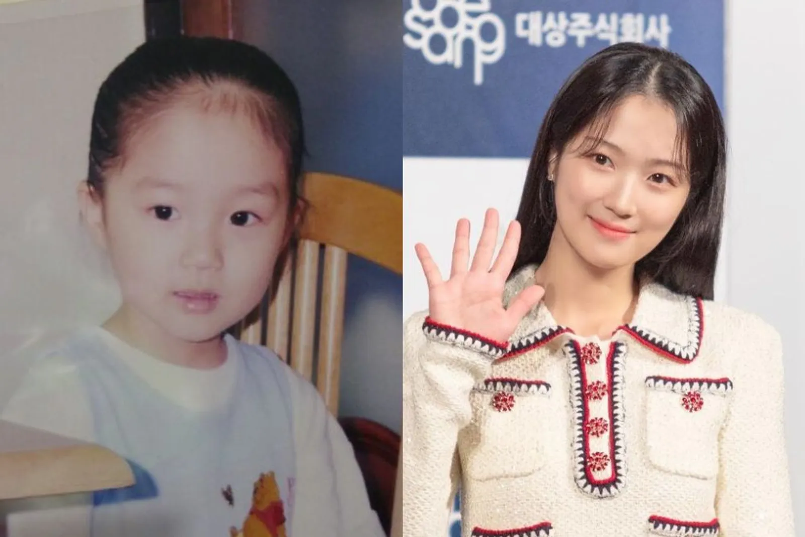 Transformasi Kim Hye Yoon, Si Pemilik Senyum Manis