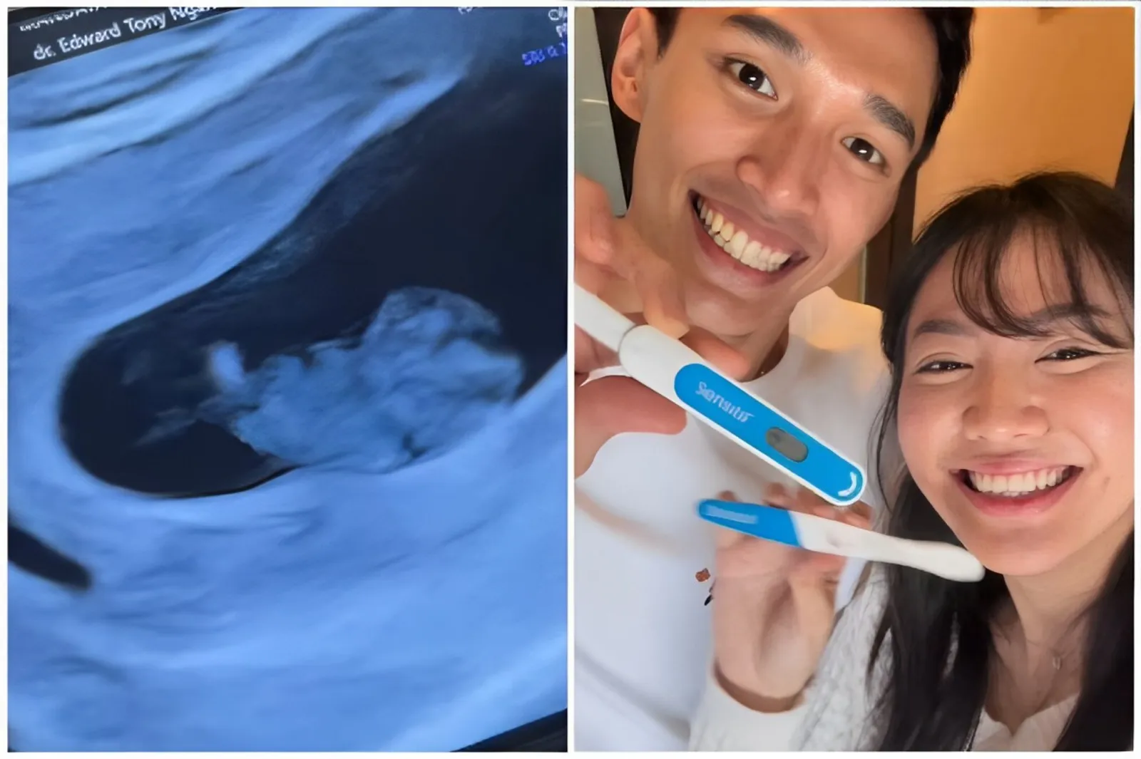 Kisah Jonatan Christie & Shanju Eks 'JKT48' Umumkan Kehamilan Pertama