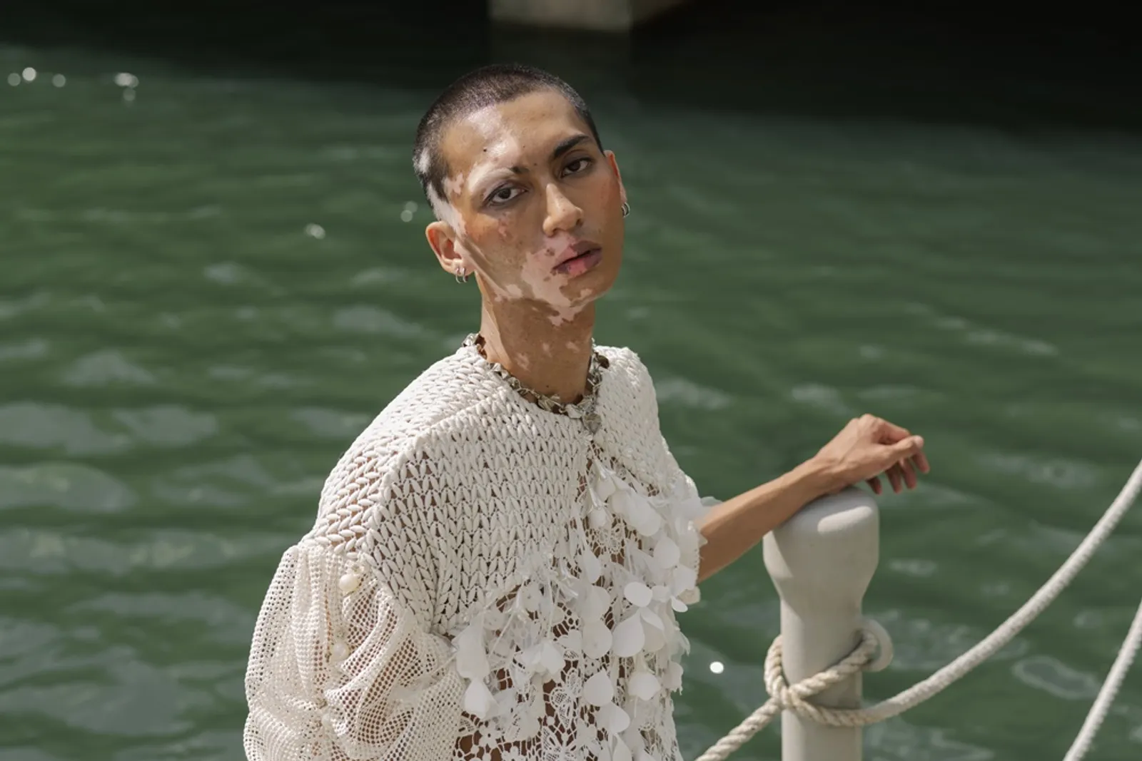 Mengulik Dwika Pradnyana, Model Unik dan Autentik dengan Vitiligo