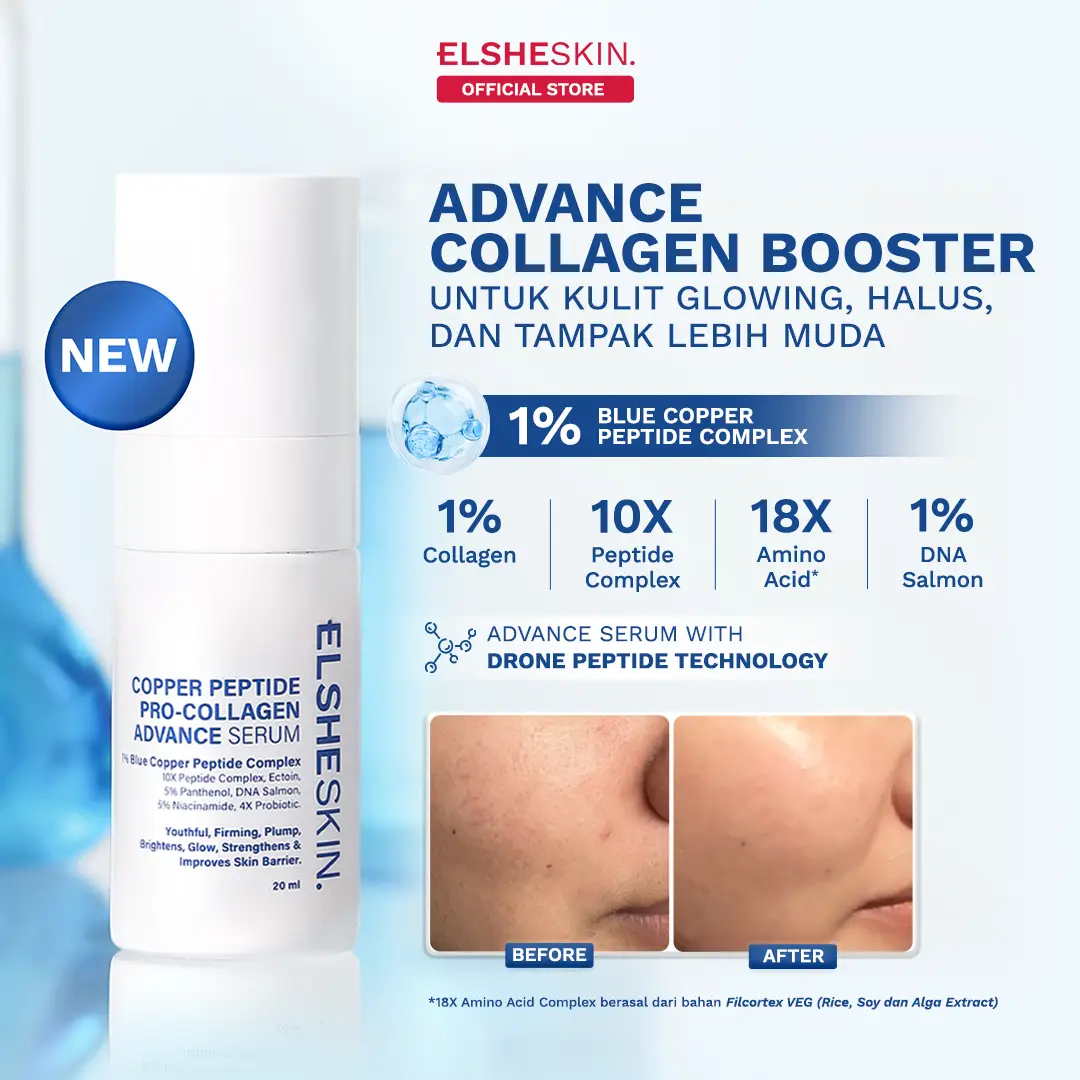 Mengandung Copper Peptide, Ini Produk Terbaru ElsheSkin