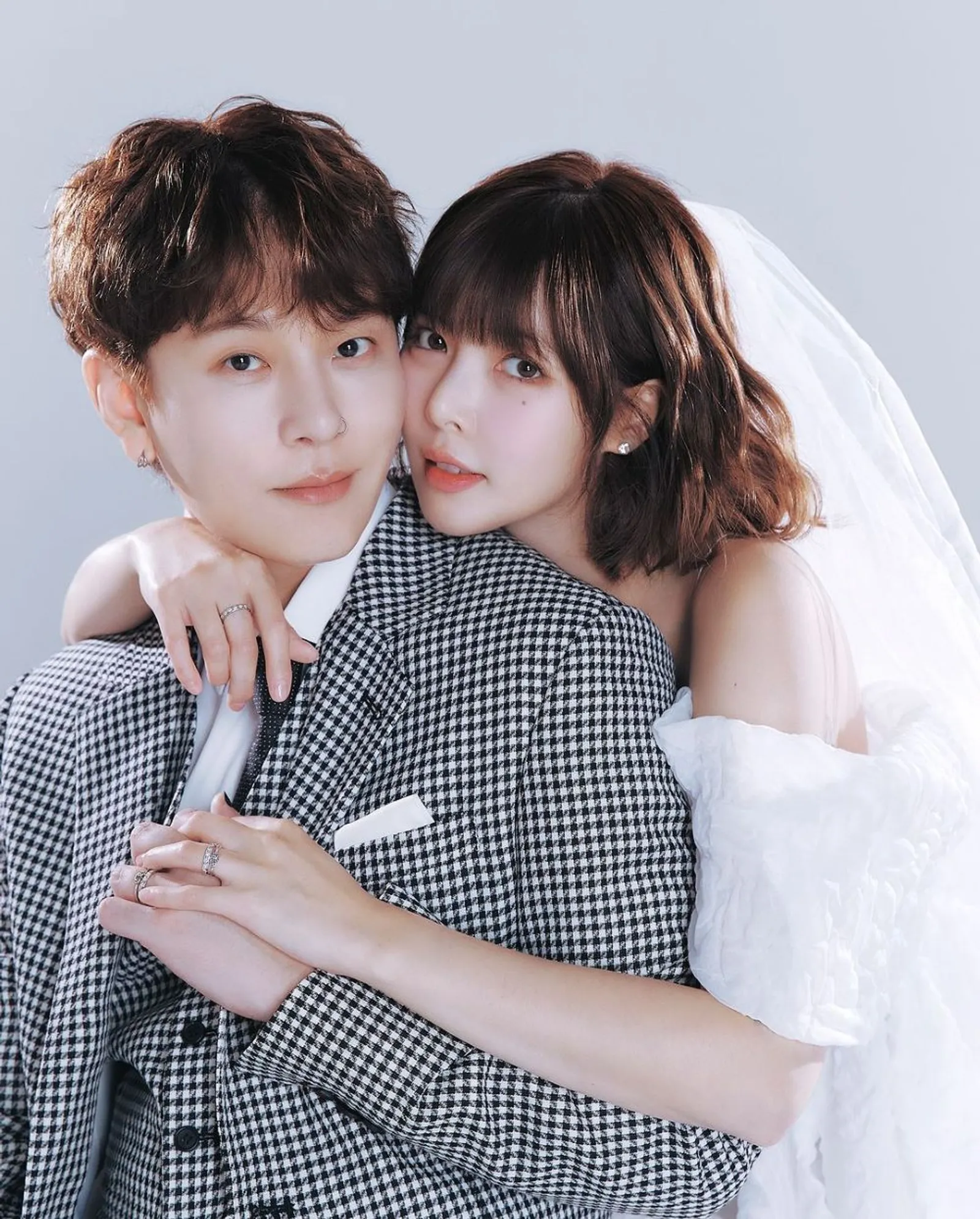 Semakin Dekat, Intip Potret Pre-Wedding HyunA dan Yong Junhyung