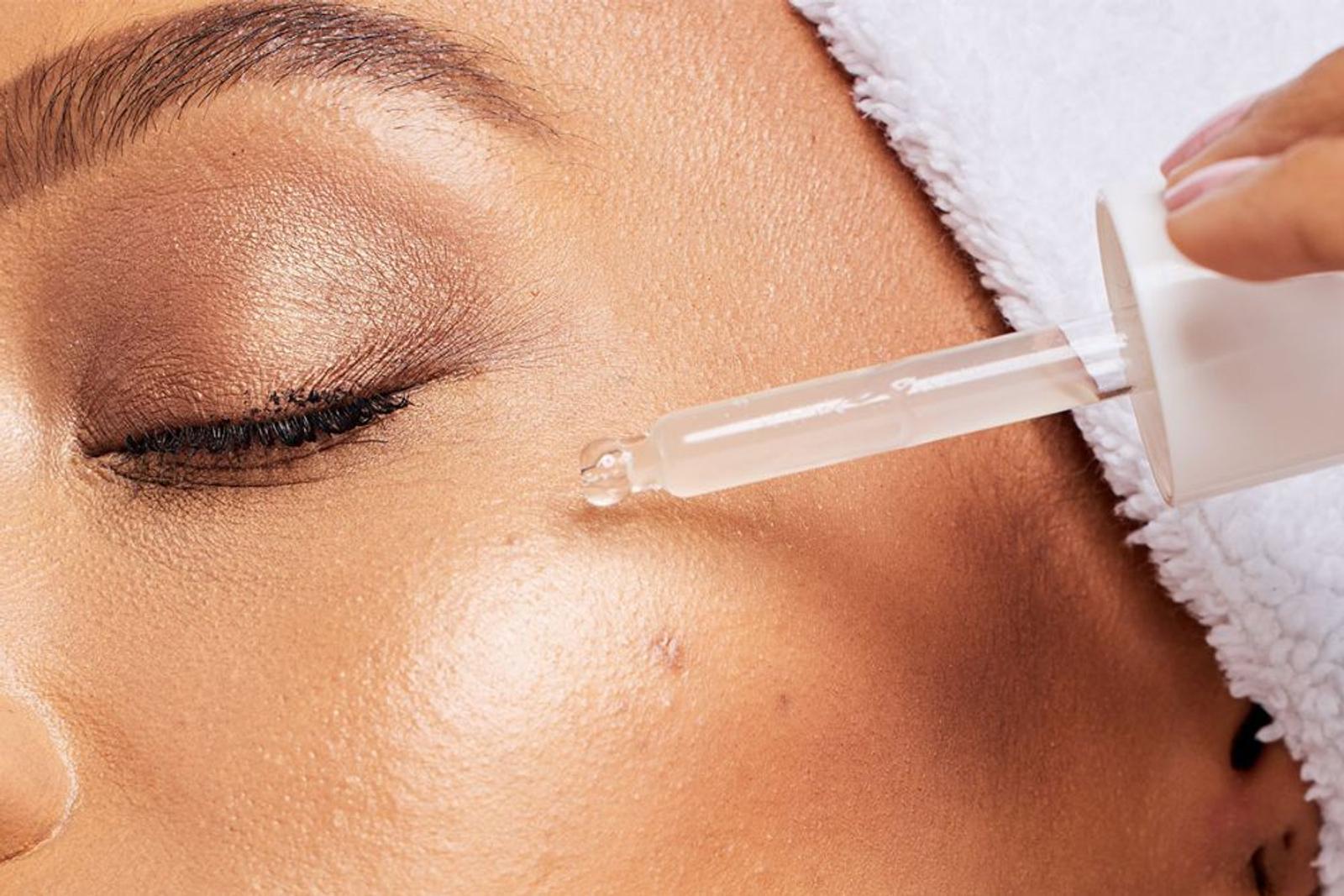 Cara Kerja Retinol pada Kulit, Anti-Aging dan Atasi Jerawat 