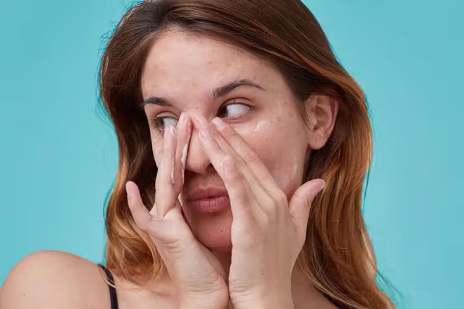 Cara Kerja Retinol pada Kulit, Anti-Aging dan Atasi Jerawat 