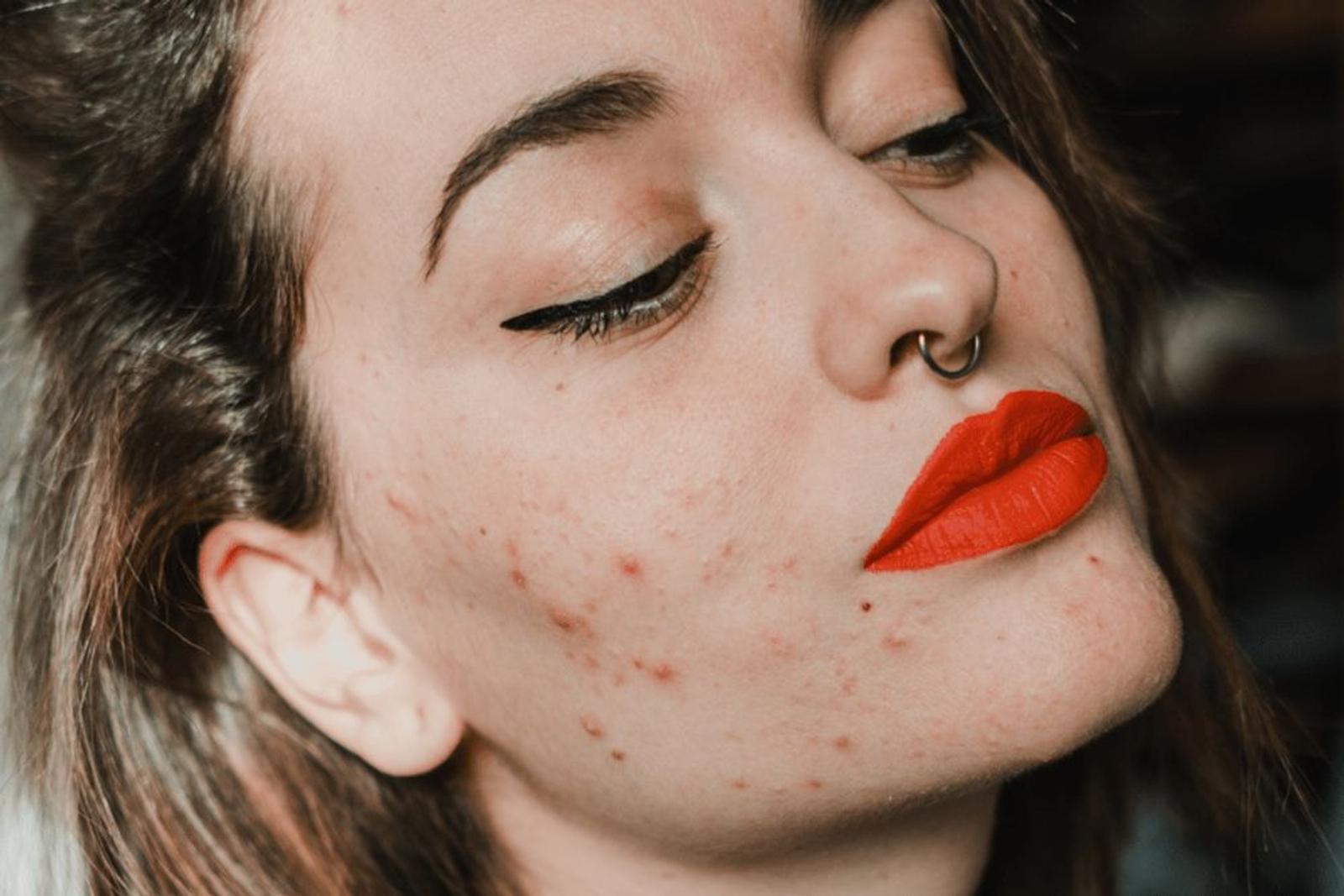 Istilah Umum Produk Kecantikan, Terutama di Skincare 