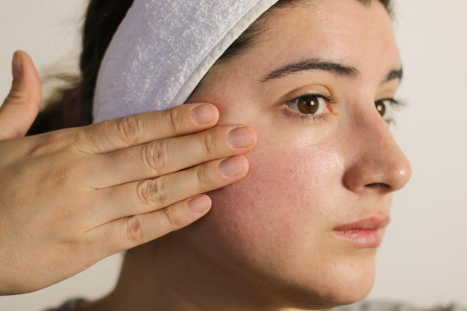 Apakah Cleansing Oil Boleh Dipakai Setiap Hari? Ini Jawabannya!