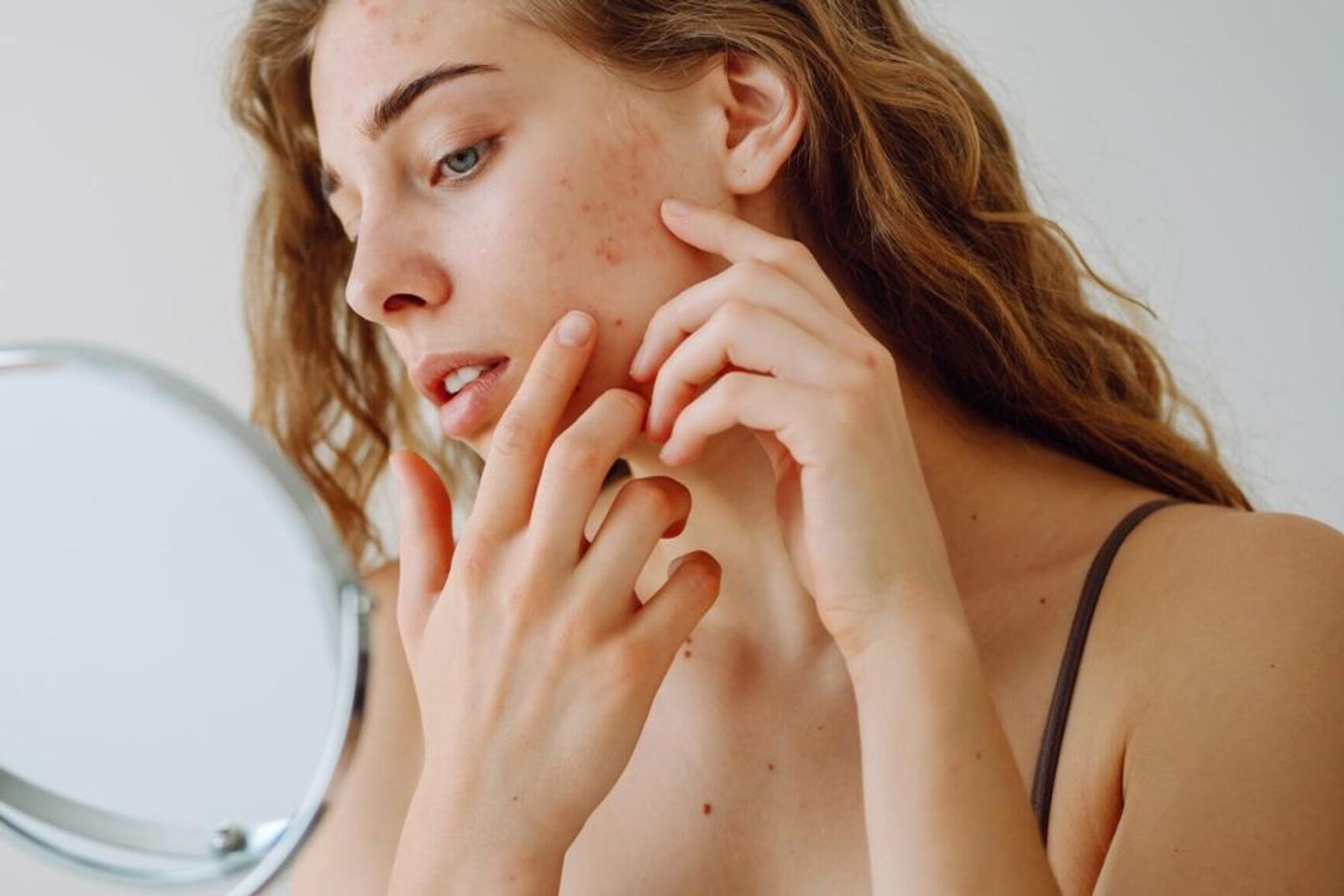 Ini Micellar Water Wardah untuk Kulit Berminyak dan Berjerawat 