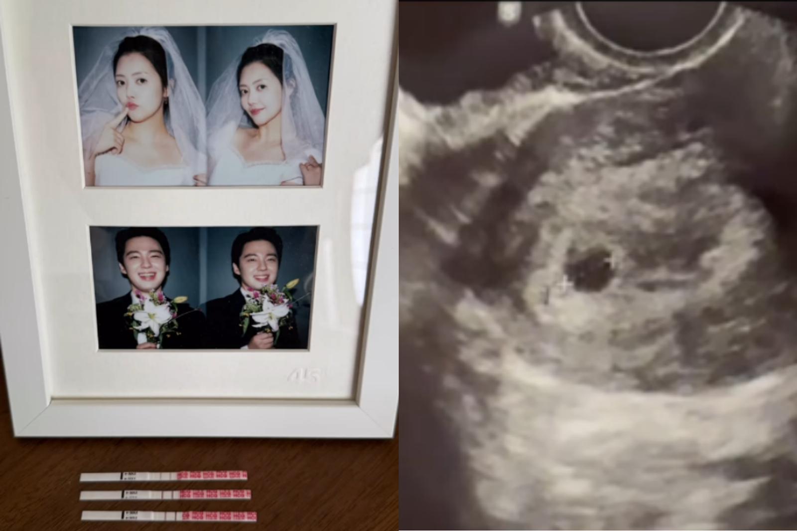 4 Bulan Nikah, Jung Yoon Hye 'Rainbow' Kini Umumkan Kehamilan Pertama