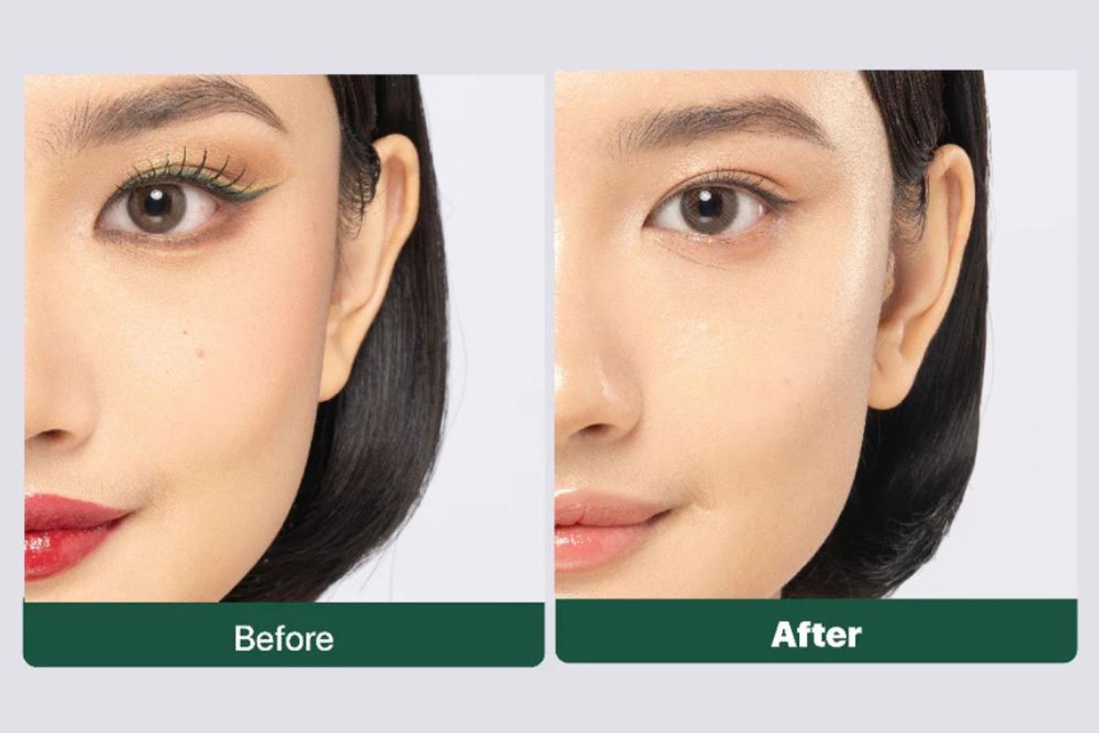 NPURE Acne Power Clear Micellar Water: Cocok untuk Kulit Berjerawat! 