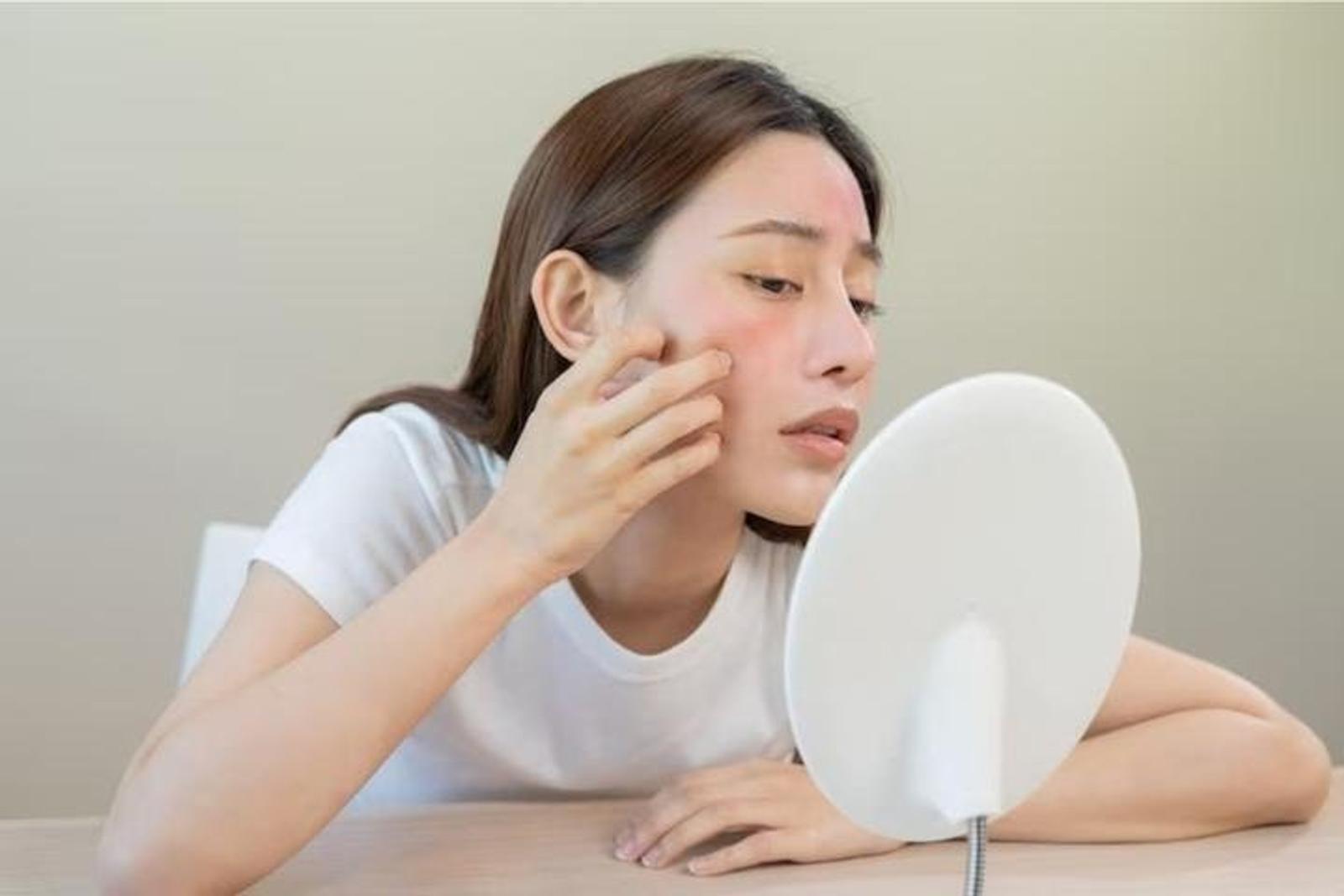 6 Ciri-Ciri Alergi Terhadap Kandungan Skincare Tertentu