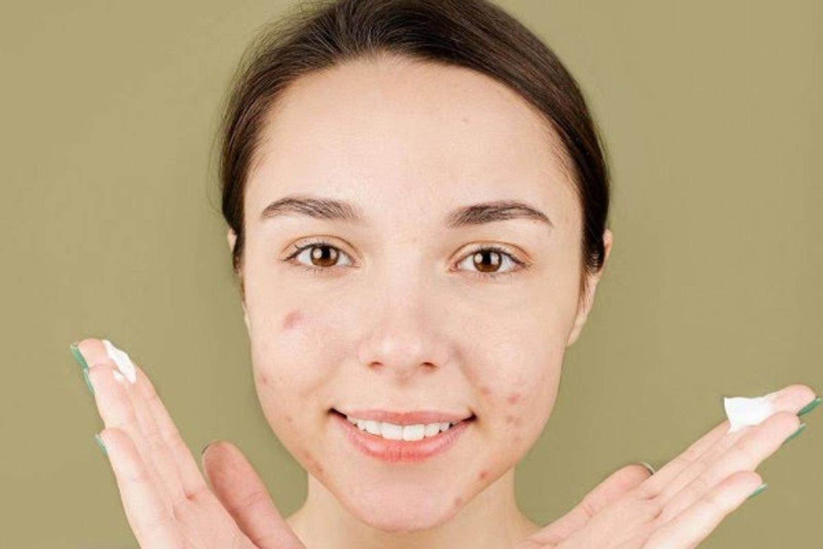 6 Ciri-Ciri Alergi Terhadap Kandungan Skincare Tertentu
