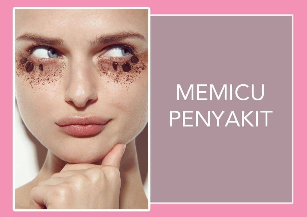 Photo: jamienelsonphoto.blogspot.co.id/Jamie Nelson For Vogue