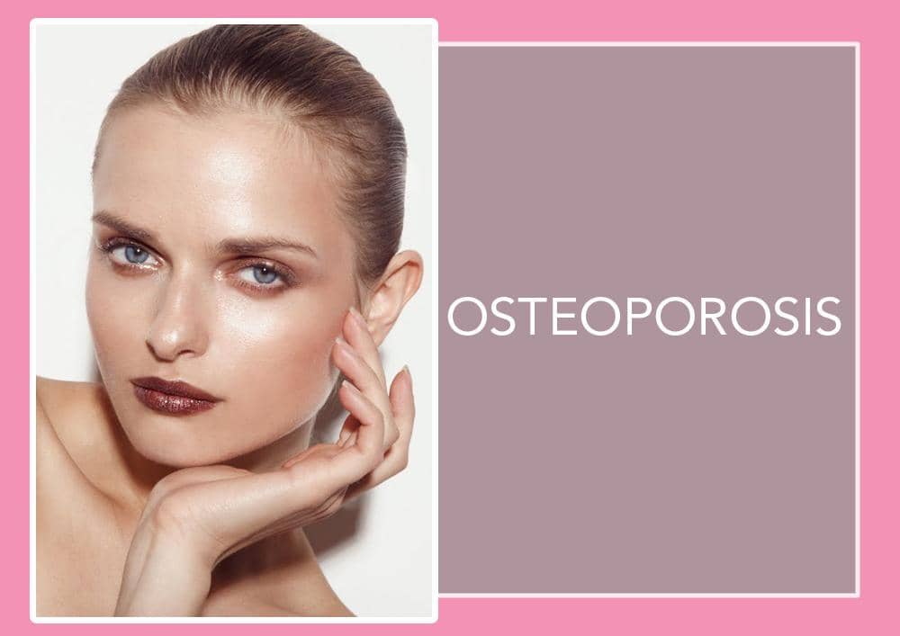 Photo: jamienelsonphoto.blogspot.co.id/Jamie Nelson For Vogue