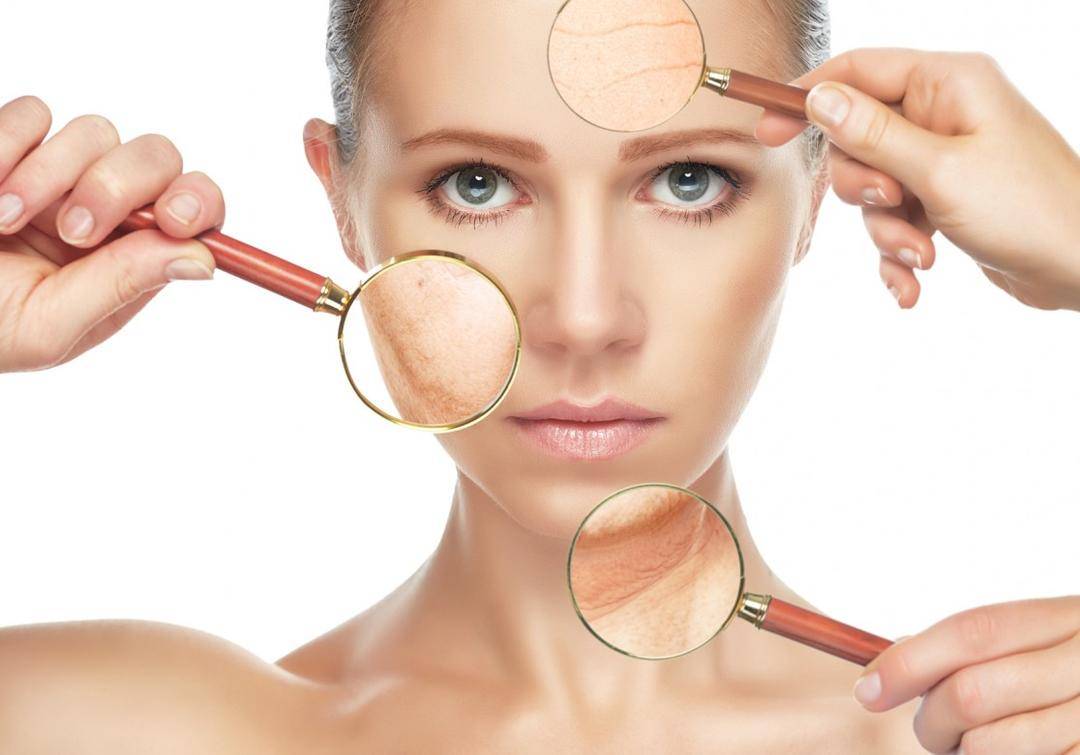 5 Cara Tepat dan Mudah Atasi Kulit Keringmu!