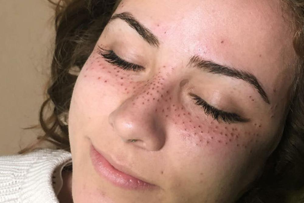 Mau Wajah Lebih Eksotis? Yuk Coba Tato Freckles Wajah Ini