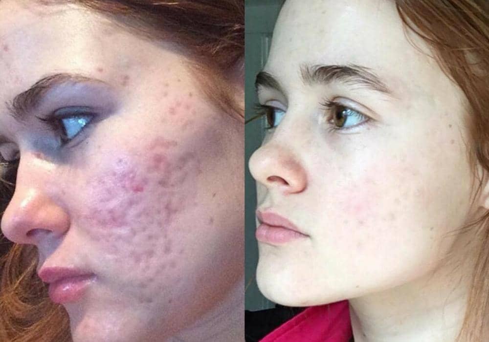 Instagram.com/myfacestory