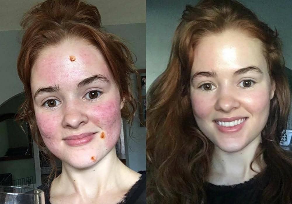 Instagram.com/myfacestory