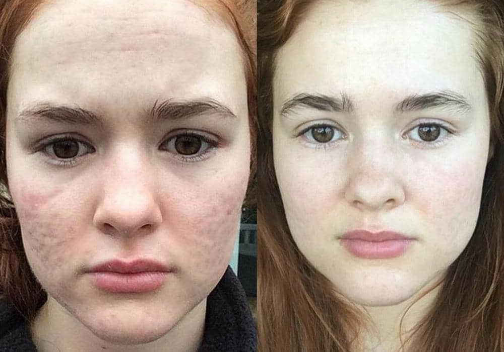 Instagram.com/myfacestory