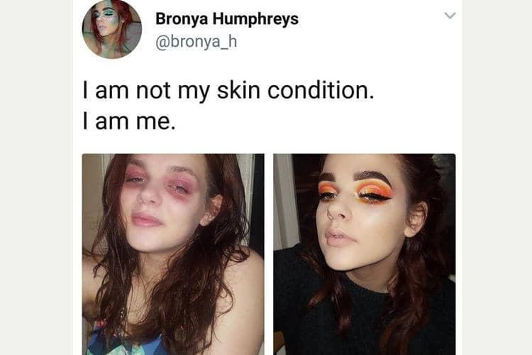 Instagram.com/@bronya_h