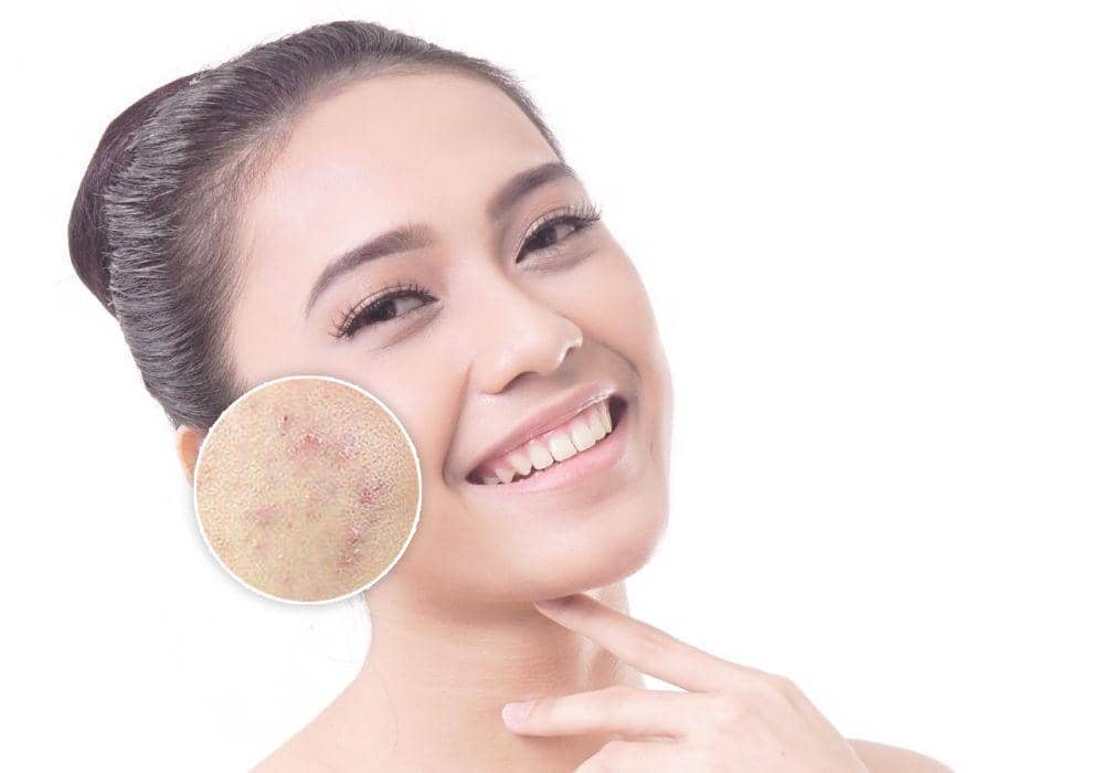 Popbela.com/ Click House