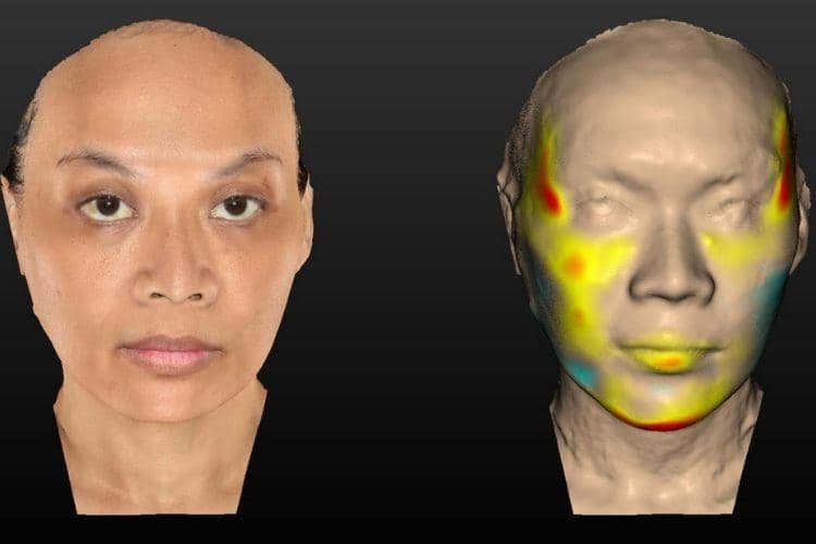 Popbela.com/ Miracle Aesthetic Clinic