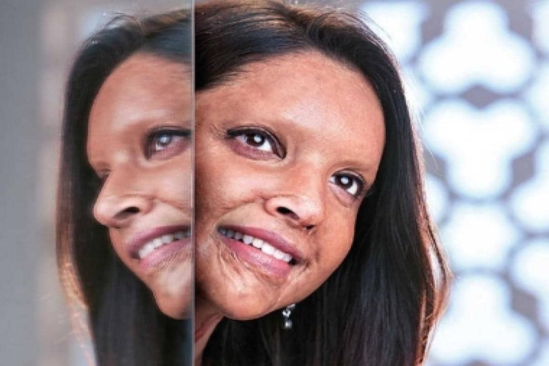 Chhapaak Movie
