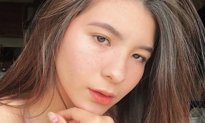 Serupa Tapi Tak Sama, Ini Perbedaan Antara Freckles dan Flek Hitam