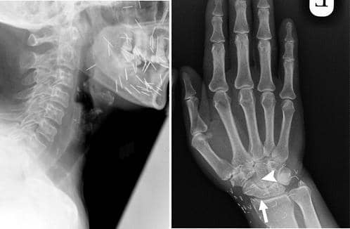 Dok. Berbagai sumber