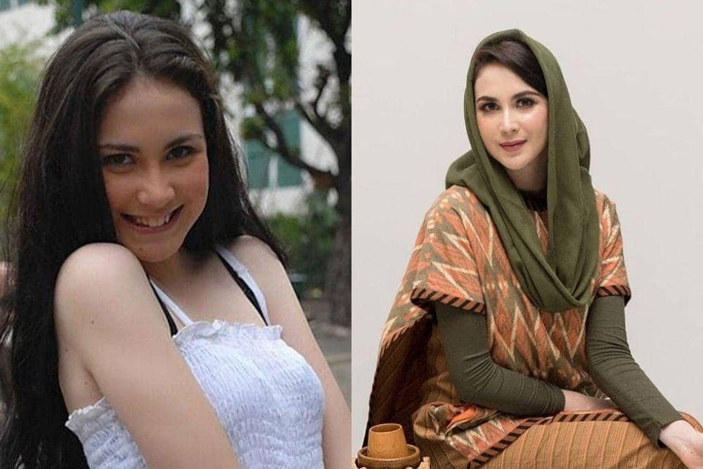 doc.internet, instagram.com/arumibachsin_94