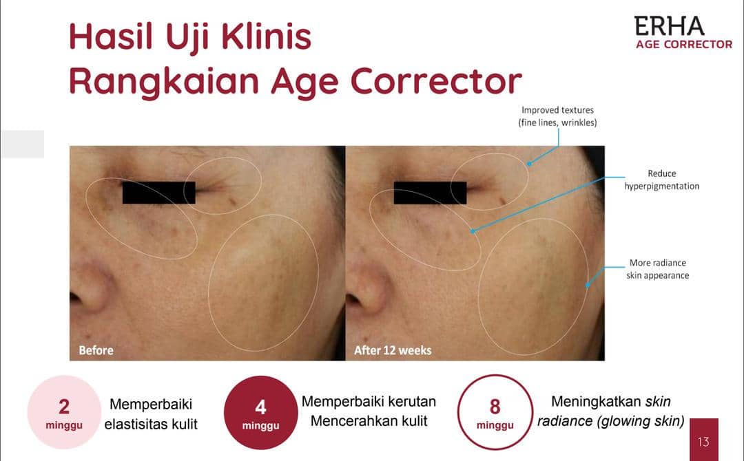 Popbela.com/Erha Age Corrector