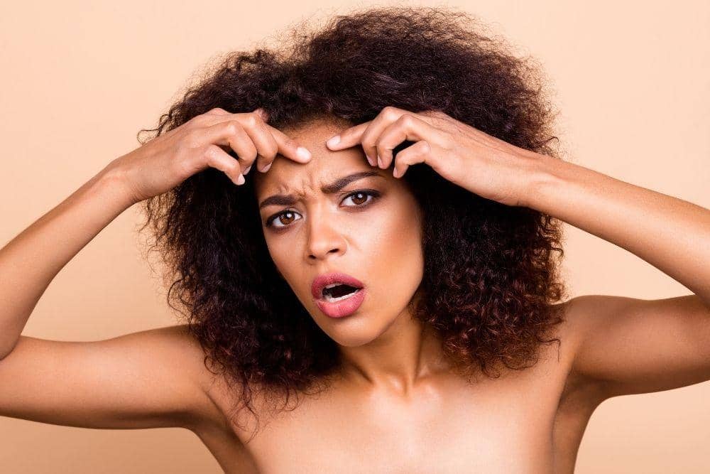 Cara Menghilangkan Bruntusan di Jidat/ freepik.com