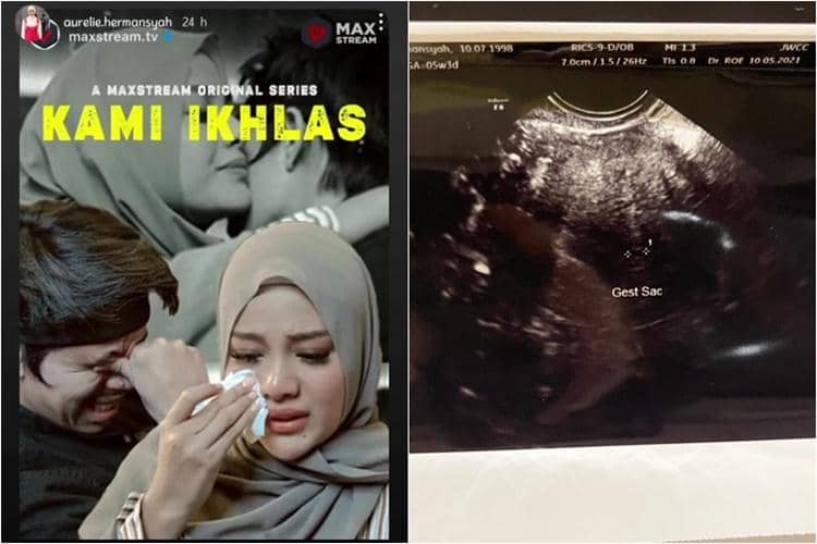 Instagram.com/aurelie.hermansyah